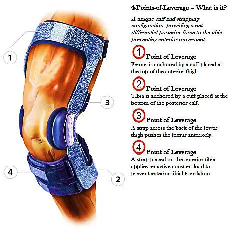 Sports Medicine Acl Tears Fishduck